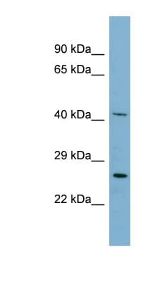 MRPS2 Antibody (N-Terminus)