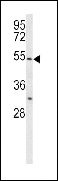 IHC-plus™ BPI Antibody (aa293-324)
