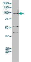 AR / Androgen Receptor Antibody (clone 1G3)