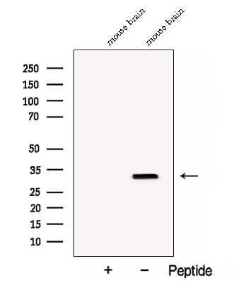 CLTB Antibody