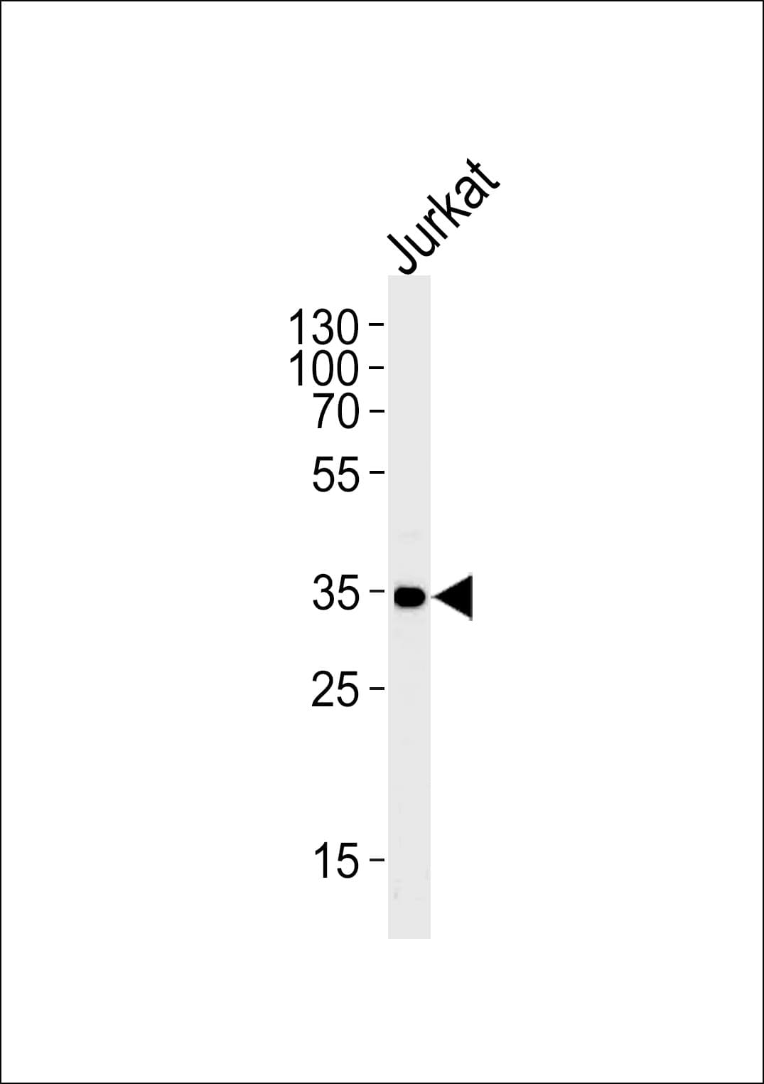 Polyclonal Rabbit anti-Human CD32A Antibody (aa255-282, WB)