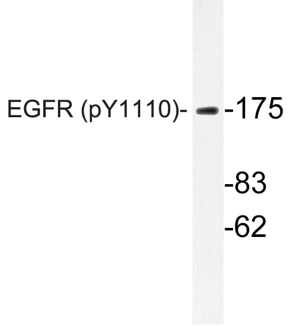 EGFR Antibody (phospho-Tyr1110)