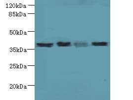 LGALS12 / Galectin 12 Antibody