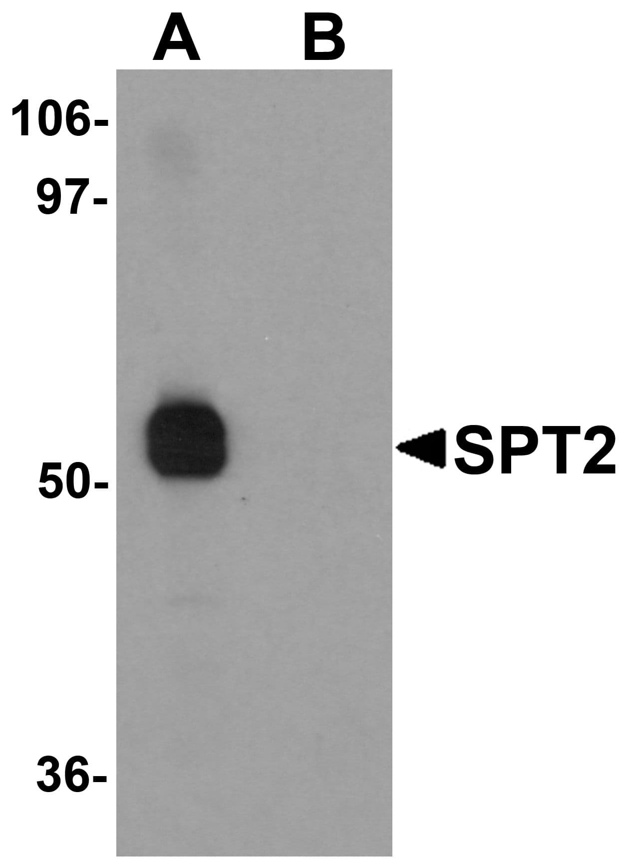 IHC-plus™ Polyclonal Rabbit anti-Human SPTLC2 / LCB2 Antibody (IHC, IF, WB)