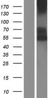 CD39 Protein (Over-Expression Lysate Myc-DDK (Flag))