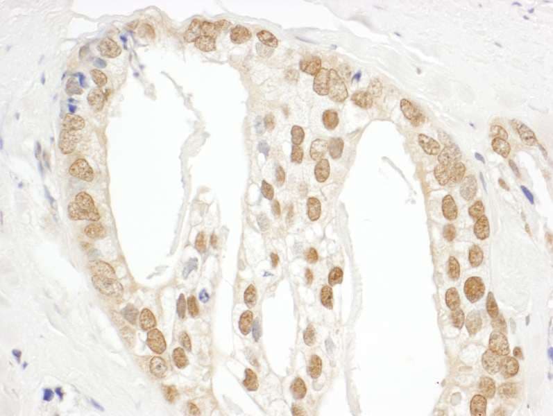 Polyclonal Rabbit anti-Human POP1 Antibody (aa925-975, IHC, IF)