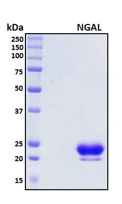 Human LCN2 / Lipocalin 2 / NGAL Protein (Recombinant 6His, N-terminus)