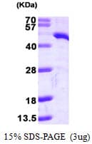 Human TDO2 Protein (Recombinant His)