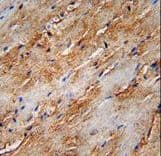 Polyclonal Rabbit anti-Human MAP1LC3B / LC3B Antibody (aa74-106, IHC, WB)
