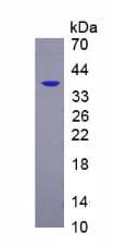 Mouse PDGFRB / PDGFR Beta Protein (Recombinant His, N-Terminal)