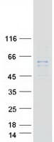 Human DGKE / DGK Epsilon Protein (Recombinant Myc-DDK (Flag))