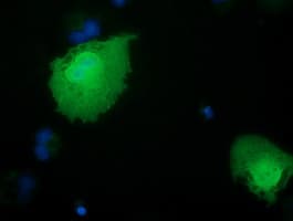 RBBP9 Antibody (clone OTI2G2)