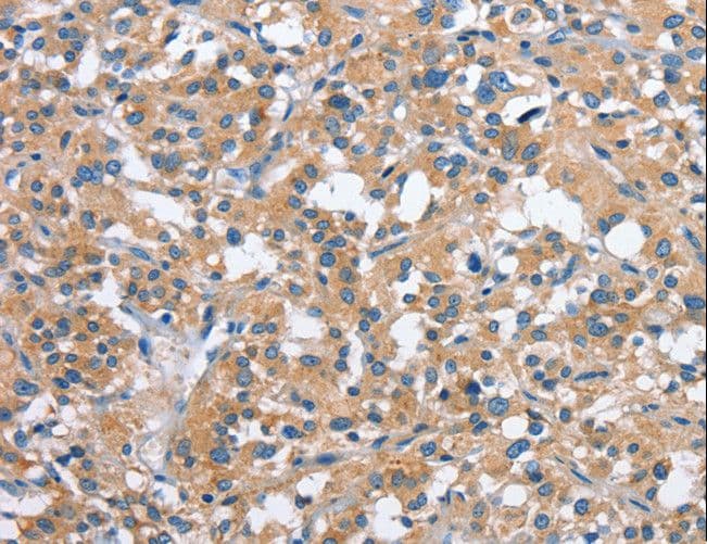 Polyclonal Rabbit anti-Human PAK2 Antibody (IHC, WB)