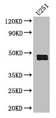 Polyclonal Rabbit anti-Human SERPINE1 / PAI-1 Antibody (WB)