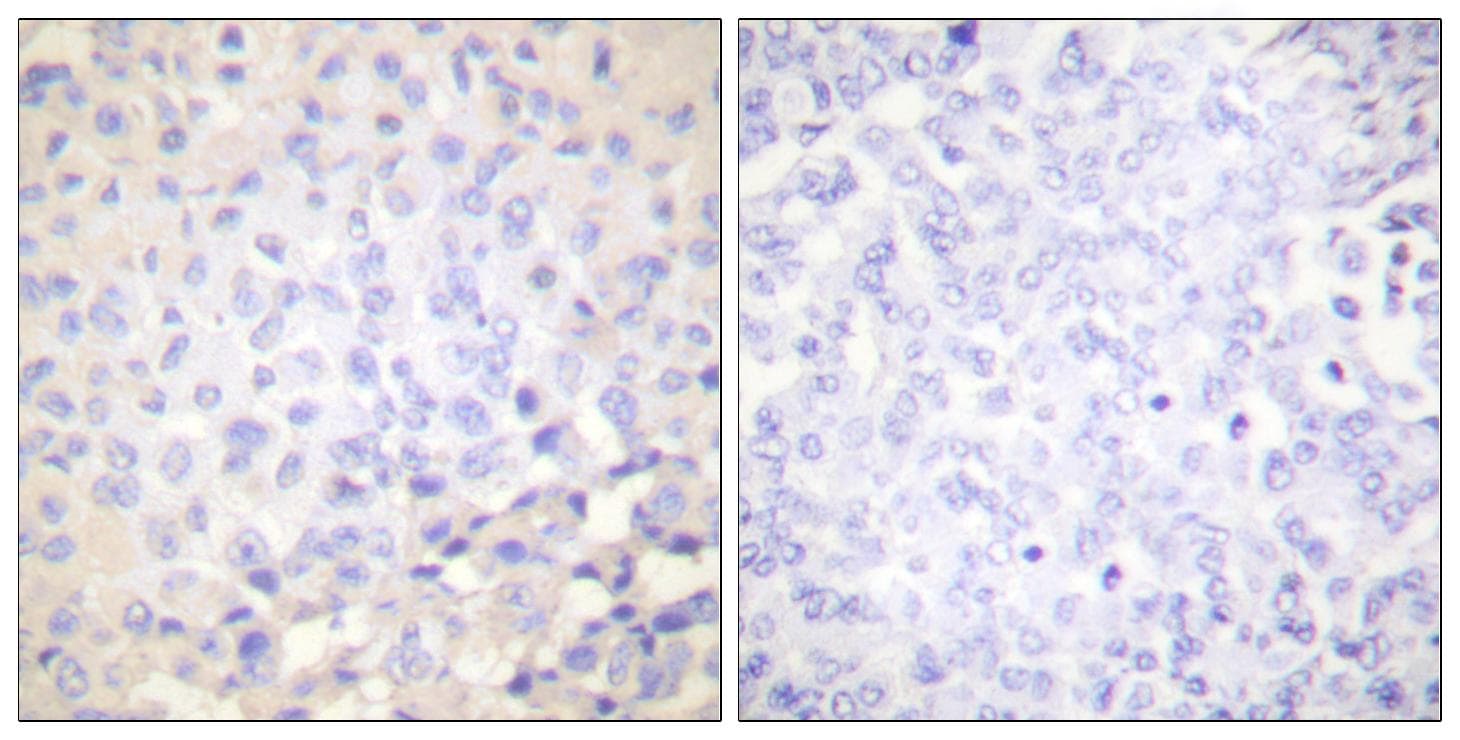 NFKBIE / IKB Epsilon Antibody (phospho-Ser22)