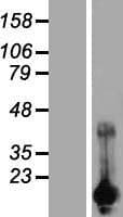 CARHSP1 Protein (Over-Expression Lysate Myc-DDK (Flag))