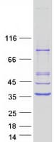 Human PYCR1 Protein (Recombinant Myc-DDK (Flag))