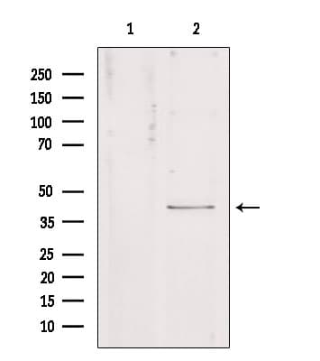 KCNJ10 / SESAME / KIR4.1 Antibody