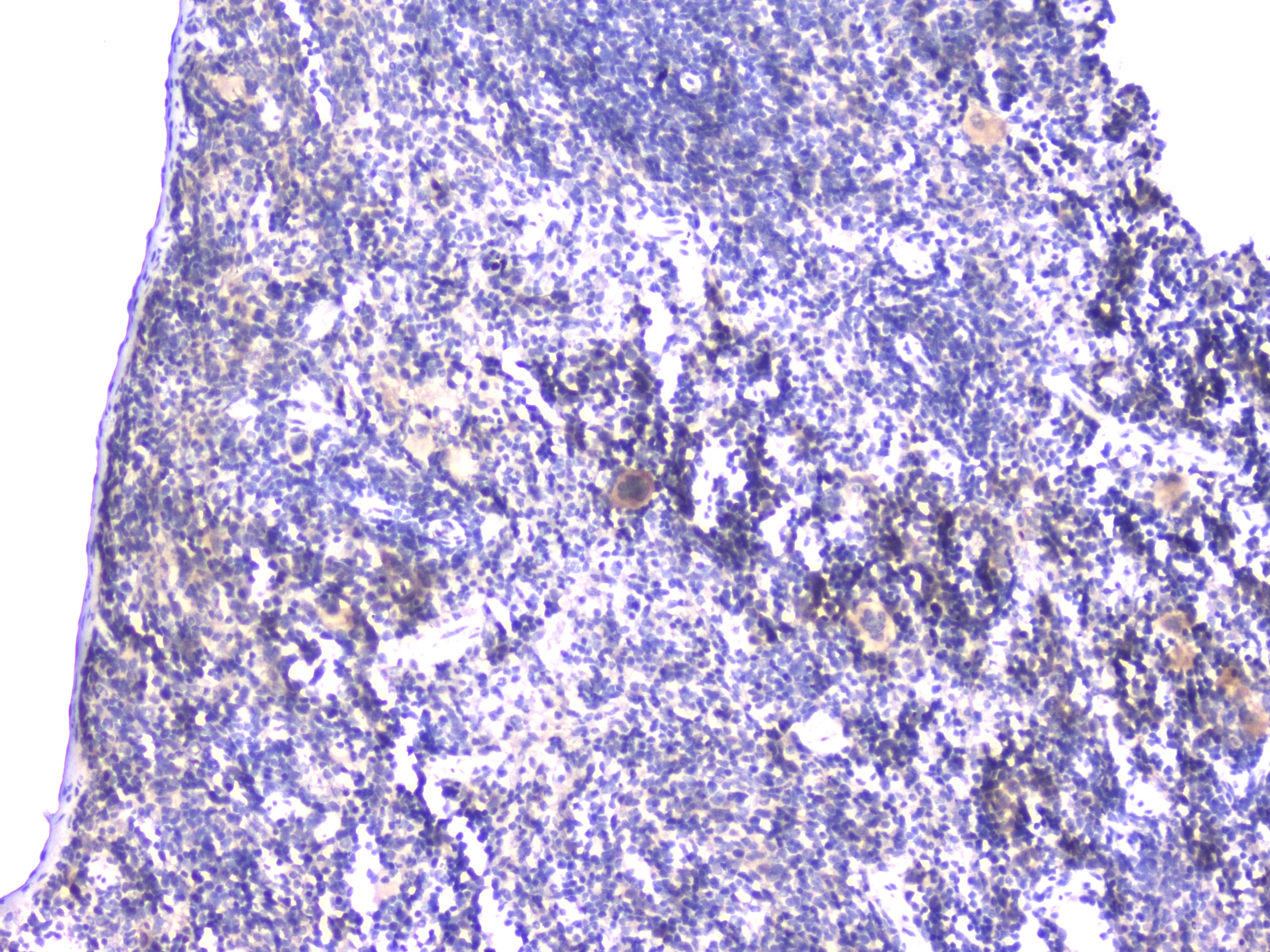 Polyclonal Rabbit anti-Human STUB1 / CHIP Antibody (IHC, WB)