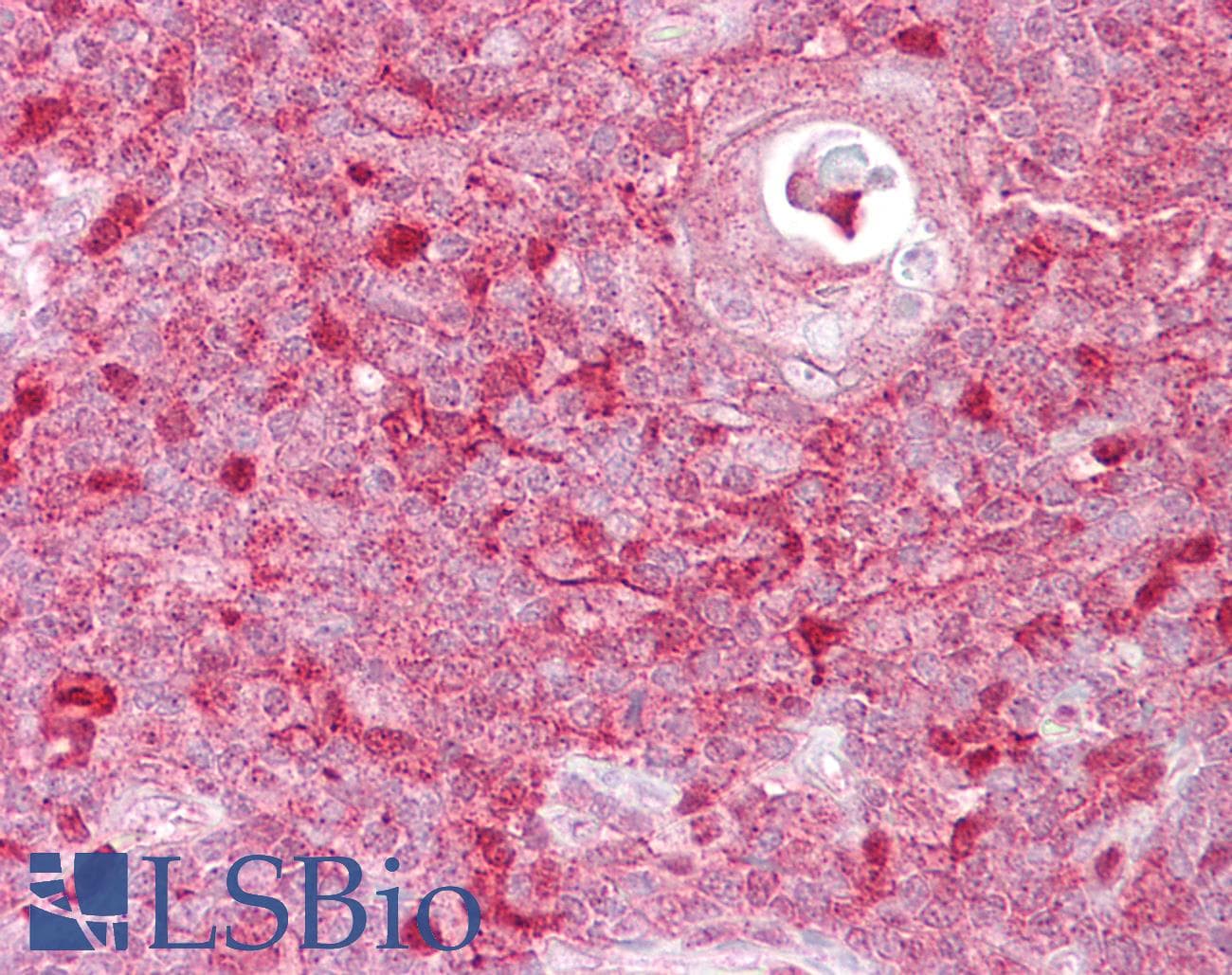 TIMELESS Antibody (aa290-339)