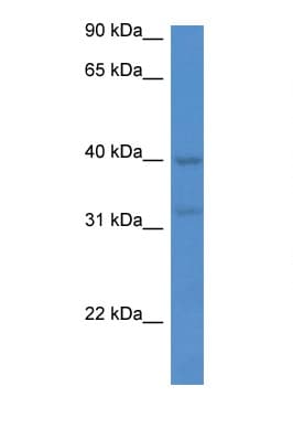 MTNR1A / Melatonin Receptor 1a Antibody (C-Terminus)