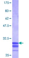Human SLC11A1 / NRAMP Protein (Recombinant GST, N-terminus)