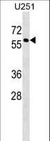 Polyclonal Rabbit anti-Human Mannose Phosphate Isomerase Antibody (aa37-65, WB)