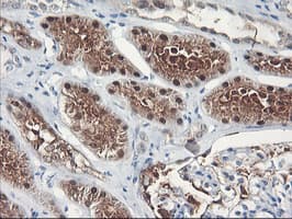 FBXO21 Antibody (clone OTI1E1)