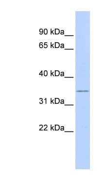 ZFP36L1 Antibody (C-Terminus)