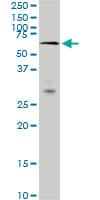 Monoclonal Mouse anti-Human MAK Antibody (clone 3E5, IF, WB)