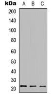 HDGFRP3 Antibody (Internal)