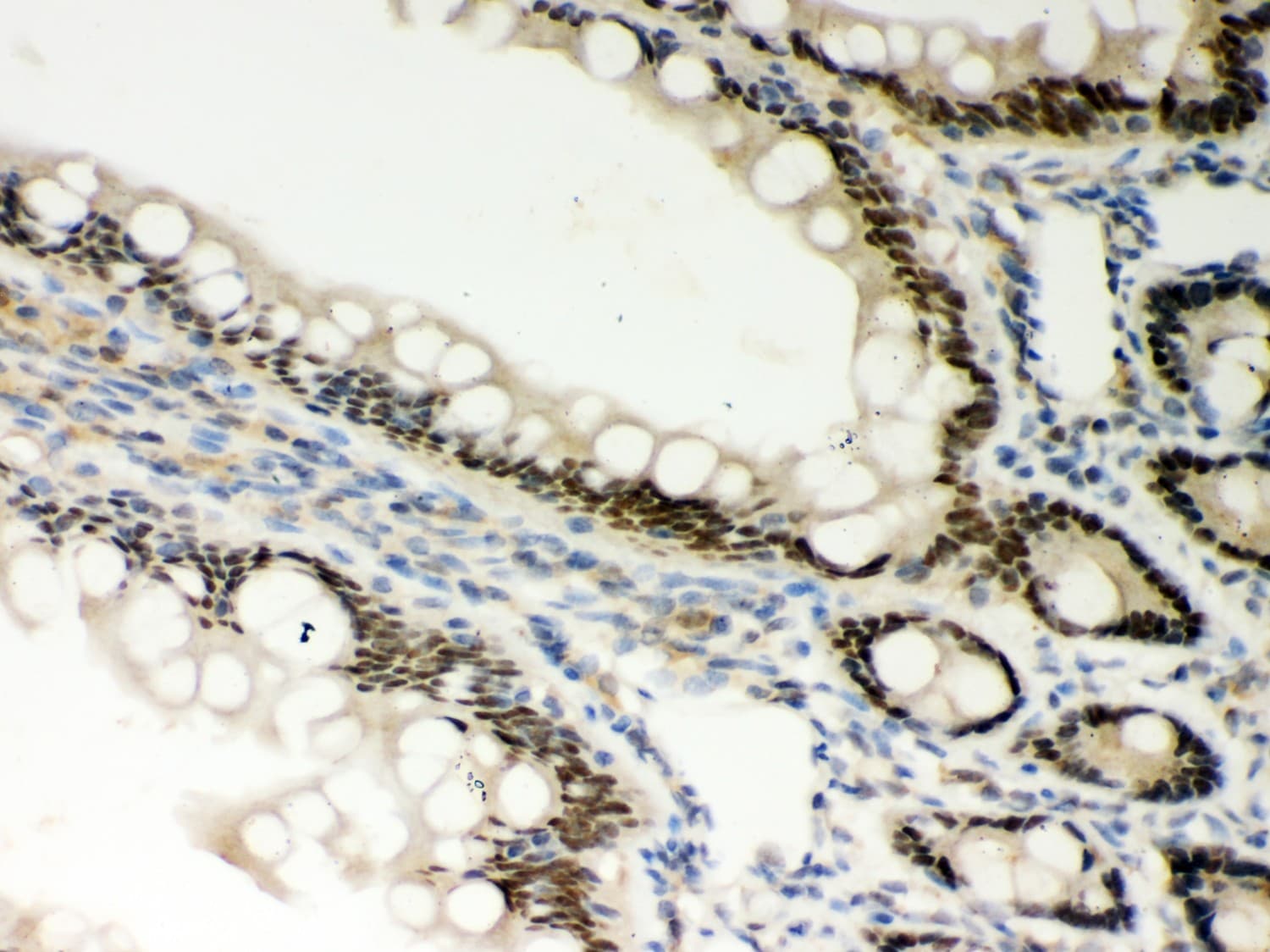 PRKCE / PKC-Epsilon Antibody (aa53-236)