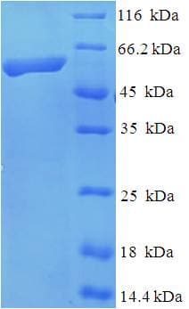 Mouse KIF1A Protein (Recombinant His-SUMO)
