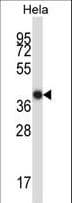 LDB2 Antibody (aa314-342)