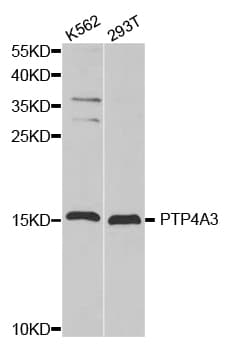 Polyclonal Rabbit anti-Human PTP4A3 Antibody (IHC, WB)