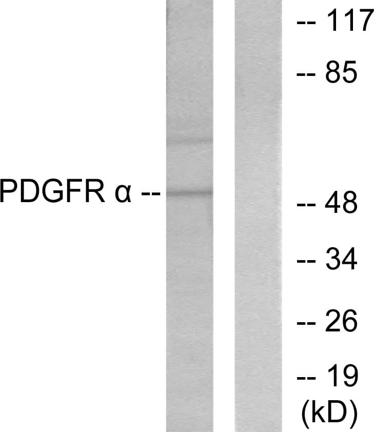 IHC-plus™ Polyclonal Rabbit anti-Human Peripherin Antibody (aa421-470, IHC, WB)