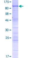 Human WDR46 Protein (Recombinant GST)