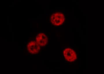 ADAP / FYB Antibody
