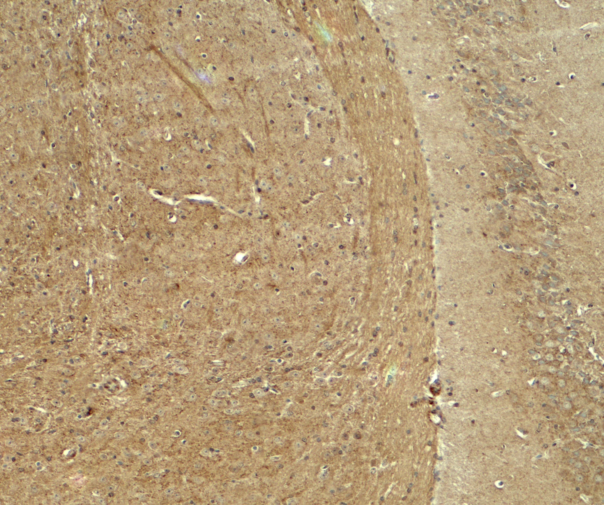 IHC-plus™ WDR61 Antibody