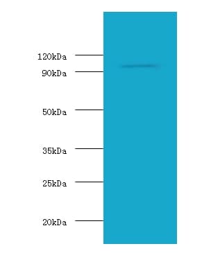 HK1 / Hexokinase 1 Antibody (Biotin)