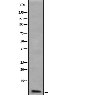 ATP5J2 / F1Fo-ATPase Antibody
