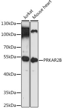 PRKAR2B Antibody