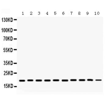 CFL1 / Cofilin Antibody (aa122-152)