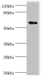 PADI4 / PAD4 Antibody (aa1-250)