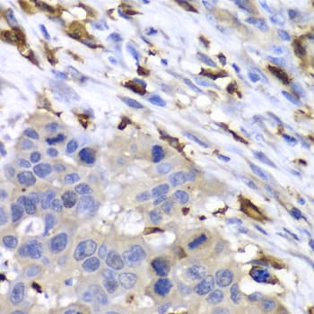 S100A8 / MRP8 Antibody
