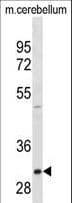 ZWINT Antibody