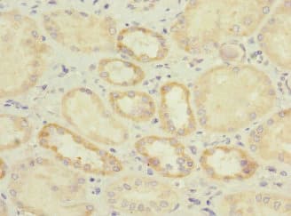 IL17RB Antibody