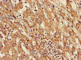 ST8SIA5 Antibody