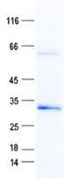 Human ECHDC2 Protein (Recombinant His, N-Terminal)