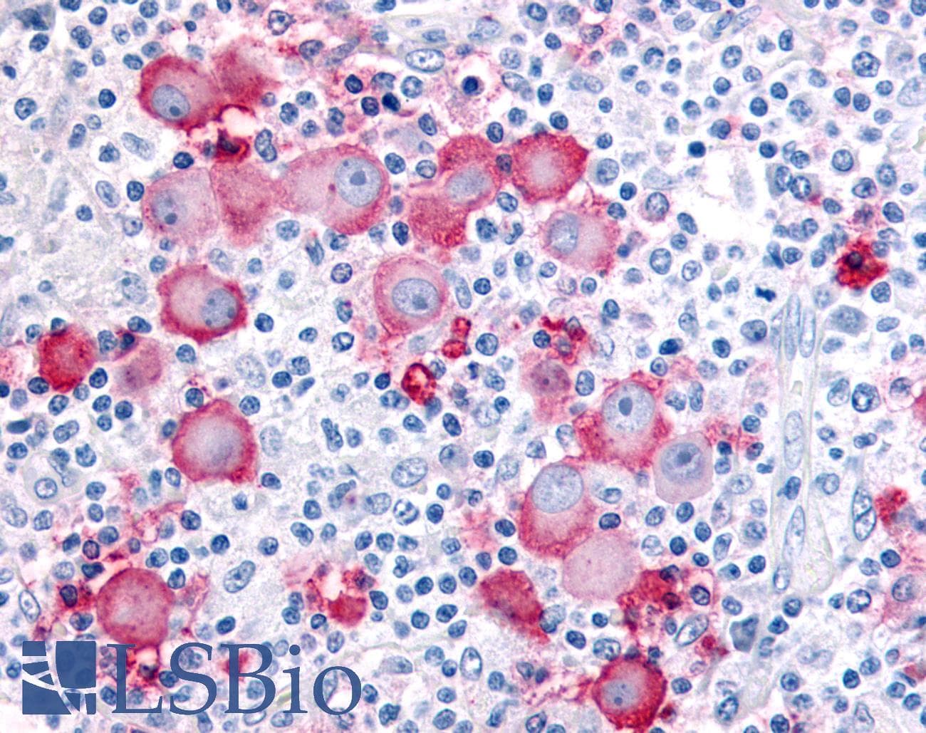 IHC-plus™ EPHX2 / Epoxide Hydrolase 2 Antibody (Internal)